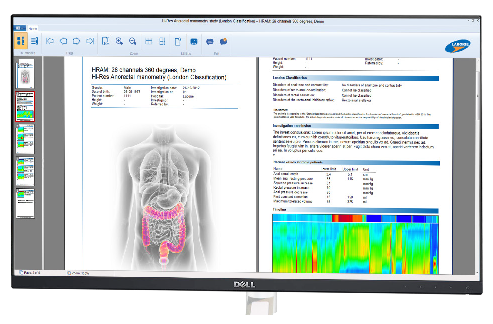 Laborie software Gastroenterology Laborie software Gastroenterology