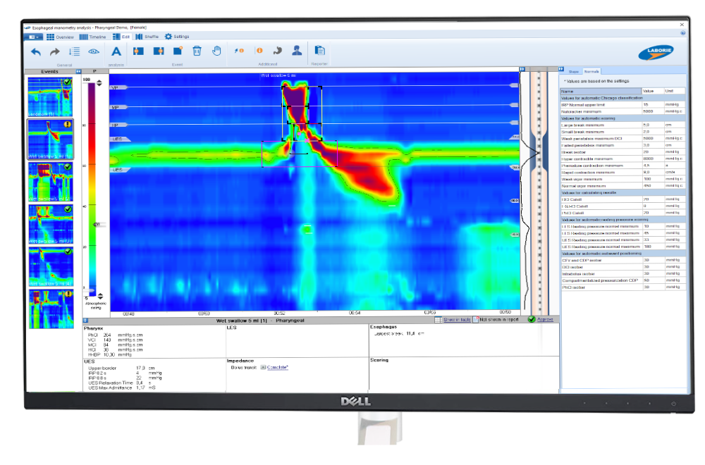Pharyngeal_screen_laborie software Pharyngeal_screen_laborie software